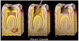 Endodontia cabinet stomatologic