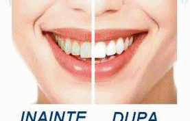 Cosmetica dentara - stomatologie - cabinet stomatologic